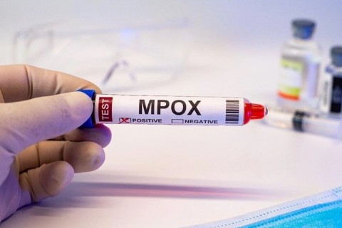 Brasil registra 48 casos de mpox em 2026